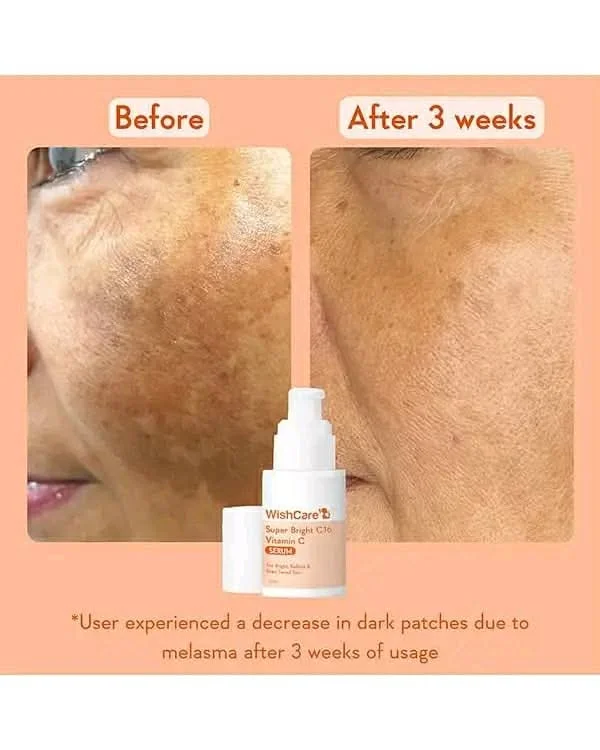 WishCare Vitamin C Super Bright Face Serum image 3