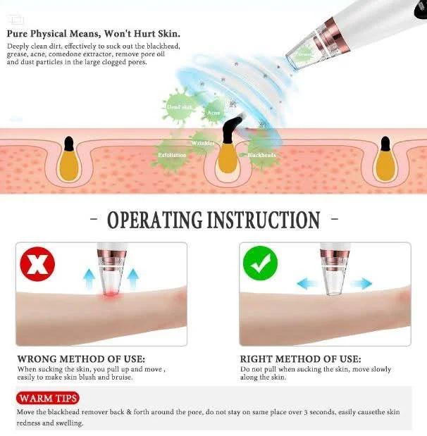 Electric Blackhead Remover Machine – Pore Vacuum Cleaner image 3