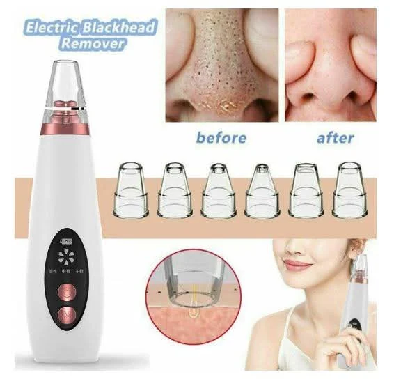 Electric Blackhead Remover Machine – Pore Vacuum Cleaner image 2