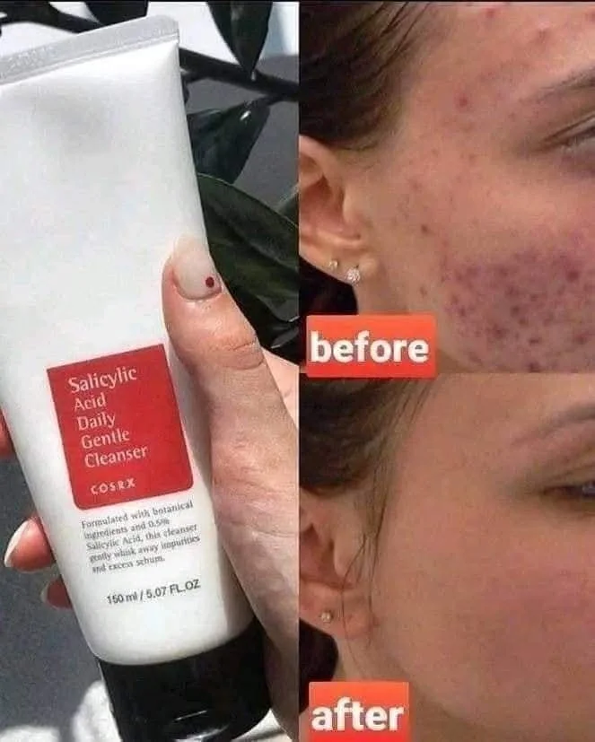 COSRX Salicylic Acid Daily Gentle Cleanser | Acne Face Wash 150ml image 2