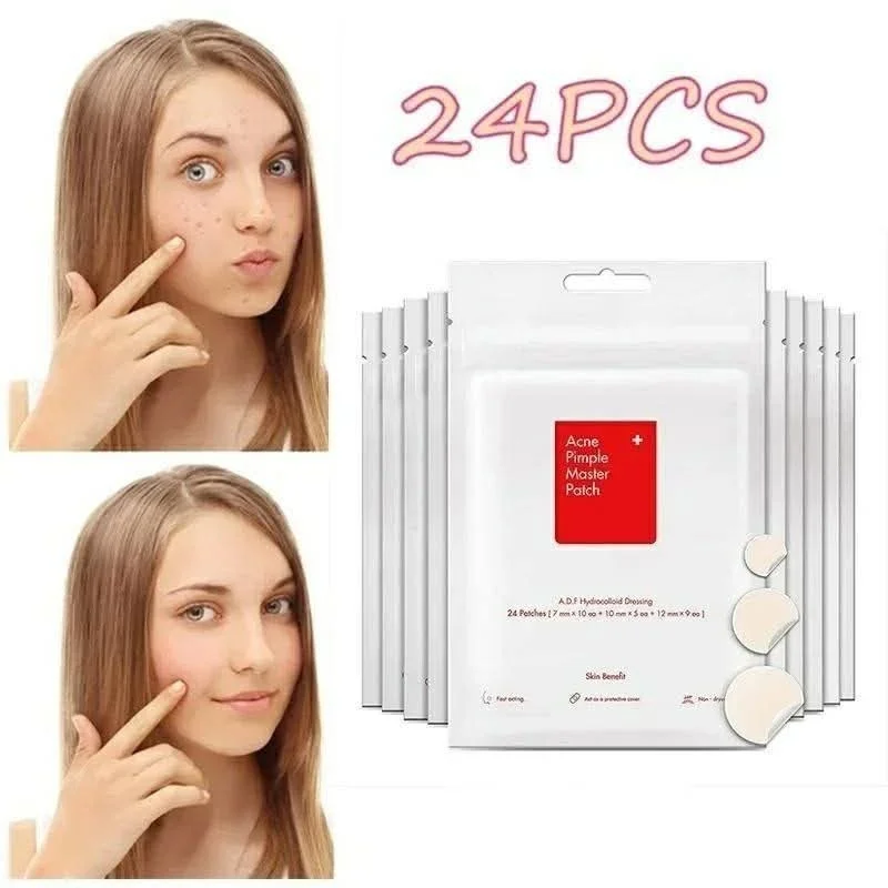 Acne Pimple Master Patch 24 PCS | Hydrocolloid Acne Spot Patch